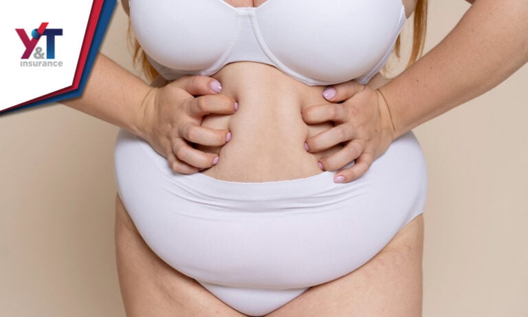 ¿Qué Seguros de Salud cubren los costos de la Cirugía Bariátrica?