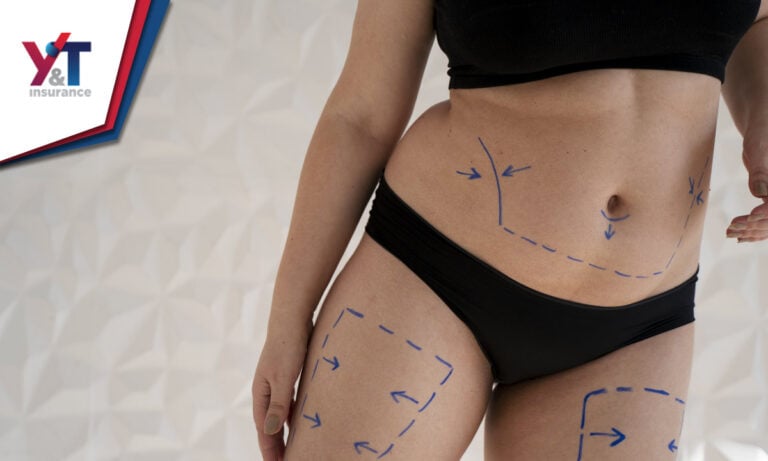 ¿Existe un Seguro Médico que cubra la cirugía estética en Florida?